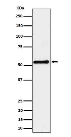 Anti-SHB Rabbit Monoclonal Antibody Boster Bio