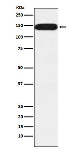 Anti-Pumilio 1 Rabbit Monoclonal Antibody Boster Bio