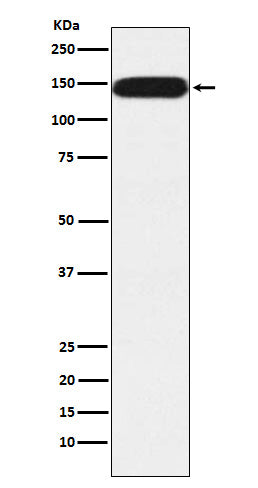 Anti-Pumilio 1 Rabbit Monoclonal Antibody Boster Bio