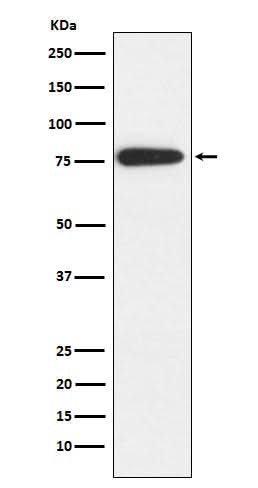 Anti-MARK2 Rabbit Monoclonal Antibody Boster Bio