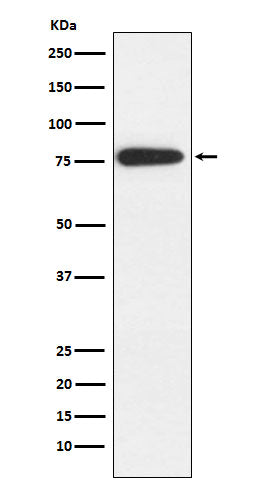 Anti-MARK2 Rabbit Monoclonal Antibody Boster Bio