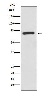 Anti-CD73 Rabbit Monoclonal Antibody Boster Bio