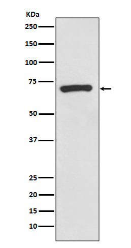 Anti-CD73 Rabbit Monoclonal Antibody Boster Bio