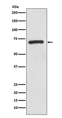 Anti-CD73 Rabbit Monoclonal Antibody Boster Bio