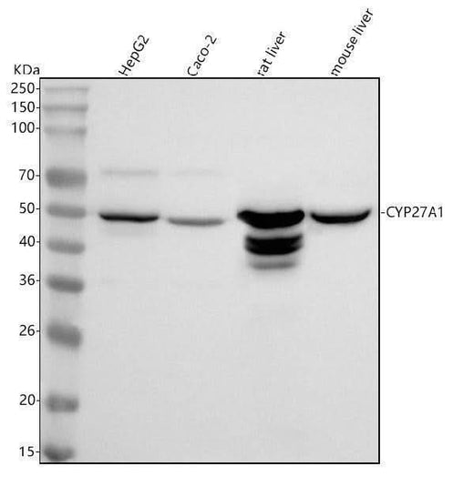 Anti-CYP27A1 Rabbit Monoclonal Antibody Boster Bio