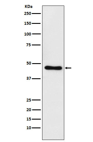Anti-CtBP1 Rabbit Monoclonal Antibody Boster Bio