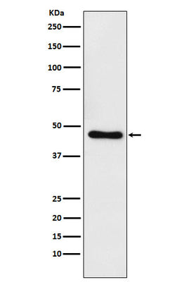 Anti-CtBP1 Rabbit Monoclonal Antibody Boster Bio
