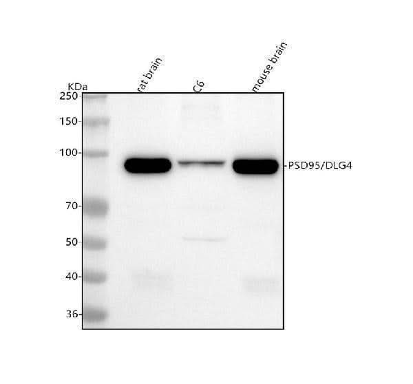Anti-PSD95 DLG4 Rabbit Monoclonal Antibody Boster Bio
