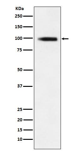 Anti-GIT1 Rabbit Monoclonal Antibody Boster Bio