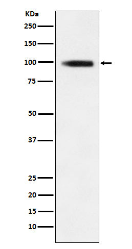 Anti-GIT1 Rabbit Monoclonal Antibody Boster Bio