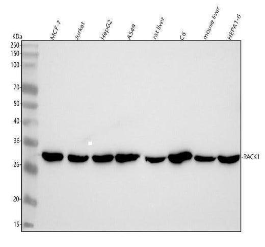 Anti-RACK1 Rabbit Monoclonal Antibody Boster Bio