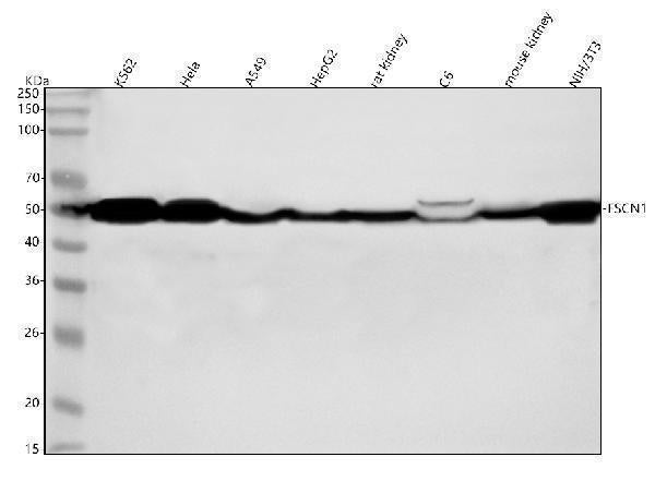 Anti-Fascin Monoclonal Antibody Boster Bio