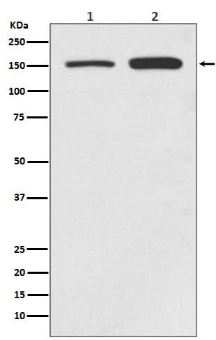 Anti-SMC1 SMC1A Rabbit Monoclonal Antibody Boster Bio