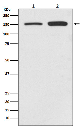 Anti-SMC1 SMC1A Rabbit Monoclonal Antibody Boster Bio
