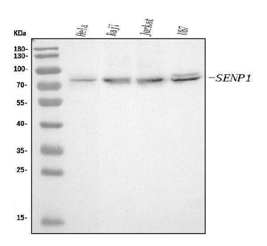 Anti-SENP1 Antibody Picoband® (monoclonal, 5F4 Boster Bio