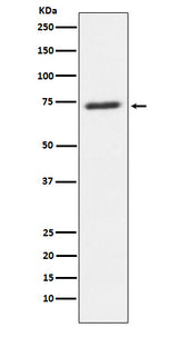 Anti-SENP1 Rabbit Monoclonal Antibody Boster Bio