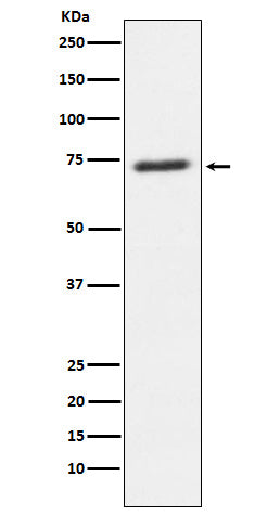 Anti-SENP1 Rabbit Monoclonal Antibody Boster Bio