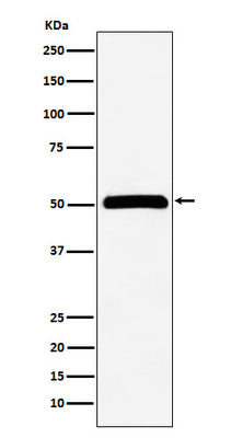 Anti-CELF1 Rabbit Monoclonal Antibody Boster Bio