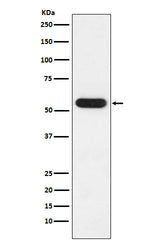 Anti-FKBP52 Rabbit Monoclonal Antibody Boster Bio