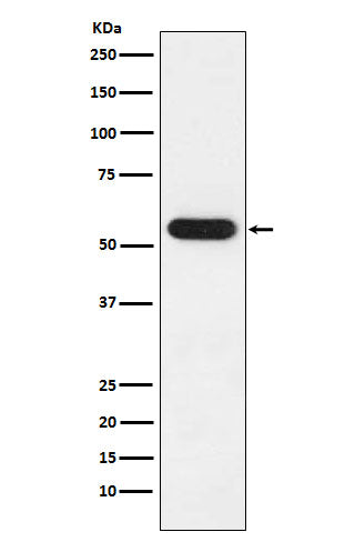 Anti-FKBP52 Rabbit Monoclonal Antibody Boster Bio