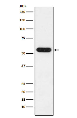 Anti-FKBP52 Rabbit Monoclonal Antibody Boster Bio