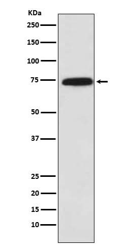 Anti-Cytochrome P450 Reductase Monoclonal Antibody Boster Bio