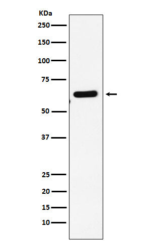 Anti-EHD1 Rabbit Monoclonal Antibody Boster Bio