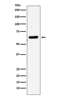 Anti-EHD1 Rabbit Monoclonal Antibody Boster Bio