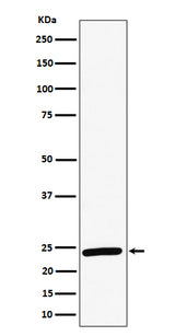 Anti-RAB8A Rabbit Monoclonal Antibody Boster Bio