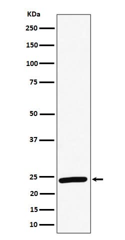 Anti-RAB8A Rabbit Monoclonal Antibody Boster Bio