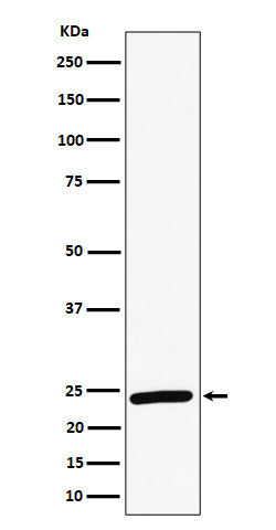 Anti-RAB8A Rabbit Monoclonal Antibody Boster Bio