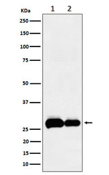 Anti-PHD3 Rabbit Monoclonal Antibody Boster Bio