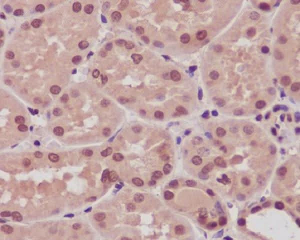 Anti-ARRB1/Beta Arrestin 1 Rabbit Monoclonal Antibody Boster Bio
