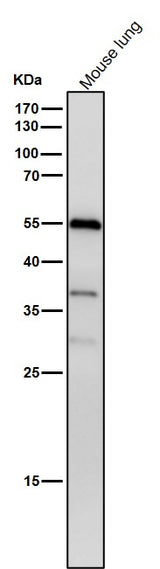 Anti-Phospho-beta Arrestin 1 (S412) Rabbit Monoclonal Antibody Boster Bio