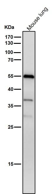 Anti-Phospho-beta Arrestin 1 (S412) Rabbit Monoclonal Antibody Boster Bio