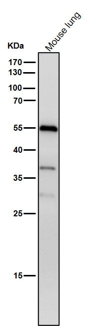Anti-Phospho-beta Arrestin 1 (S412) Rabbit Monoclonal Antibody Boster Bio