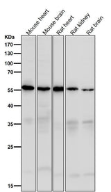 Anti-Caspase-10 Rabbit Monoclonal Antibody Boster Bio