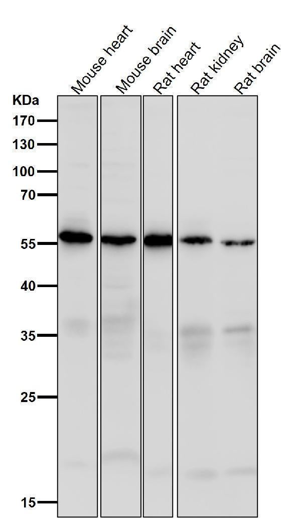 Anti-Caspase-10 Rabbit Monoclonal Antibody Boster Bio