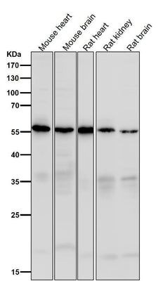 Anti-Caspase-10 Rabbit Monoclonal Antibody Boster Bio