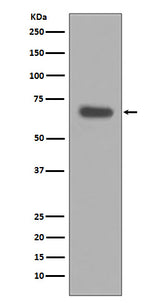 Anti-pro Caspase 10 Rabbit Monoclonal Antibody Boster Bio