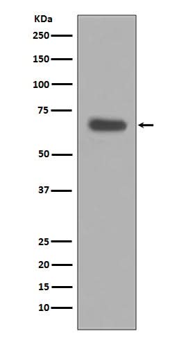 Anti-pro Caspase 10 Rabbit Monoclonal Antibody Boster Bio