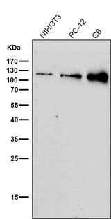 Anti-Nesprin 1 Rabbit Monoclonal Antibody Boster Bio