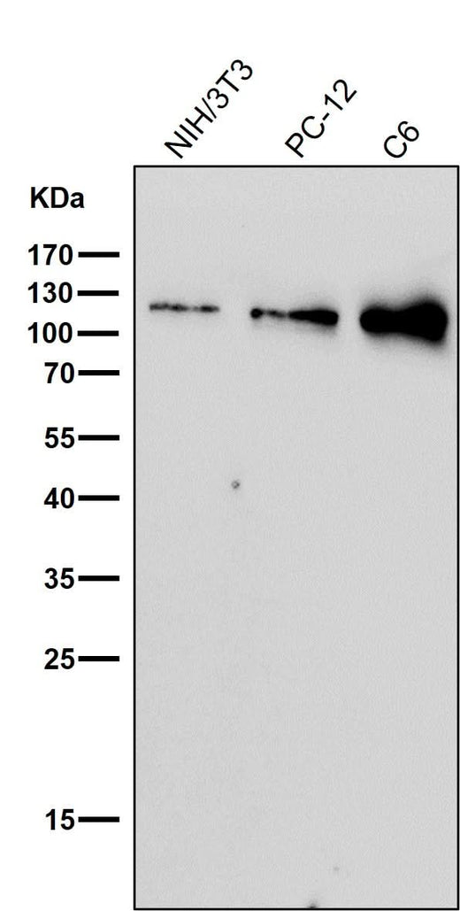 Anti-Nesprin 1 Rabbit Monoclonal Antibody Boster Bio