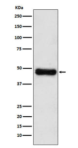 Anti-ADK Rabbit Monoclonal Antibody Boster Bio