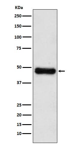 Anti-ADK Rabbit Monoclonal Antibody Boster Bio