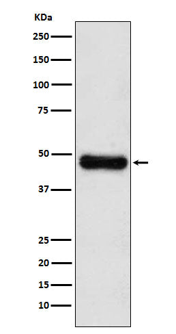 Anti-ADK Rabbit Monoclonal Antibody Boster Bio