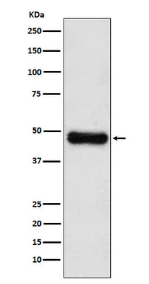 Anti-ADK Rabbit Monoclonal Antibody Boster Bio