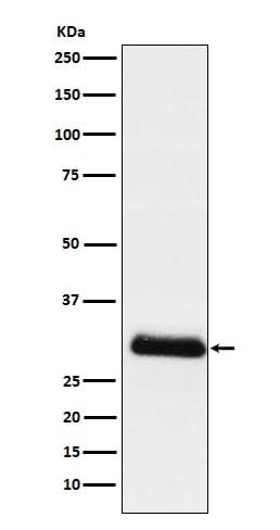 Anti-ApoD Rabbit Monoclonal Antibody Boster Bio