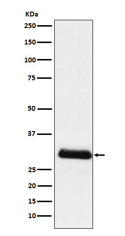 Anti-ApoD Rabbit Monoclonal Antibody Boster Bio