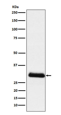 Anti-ApoD Rabbit Monoclonal Antibody Boster Bio